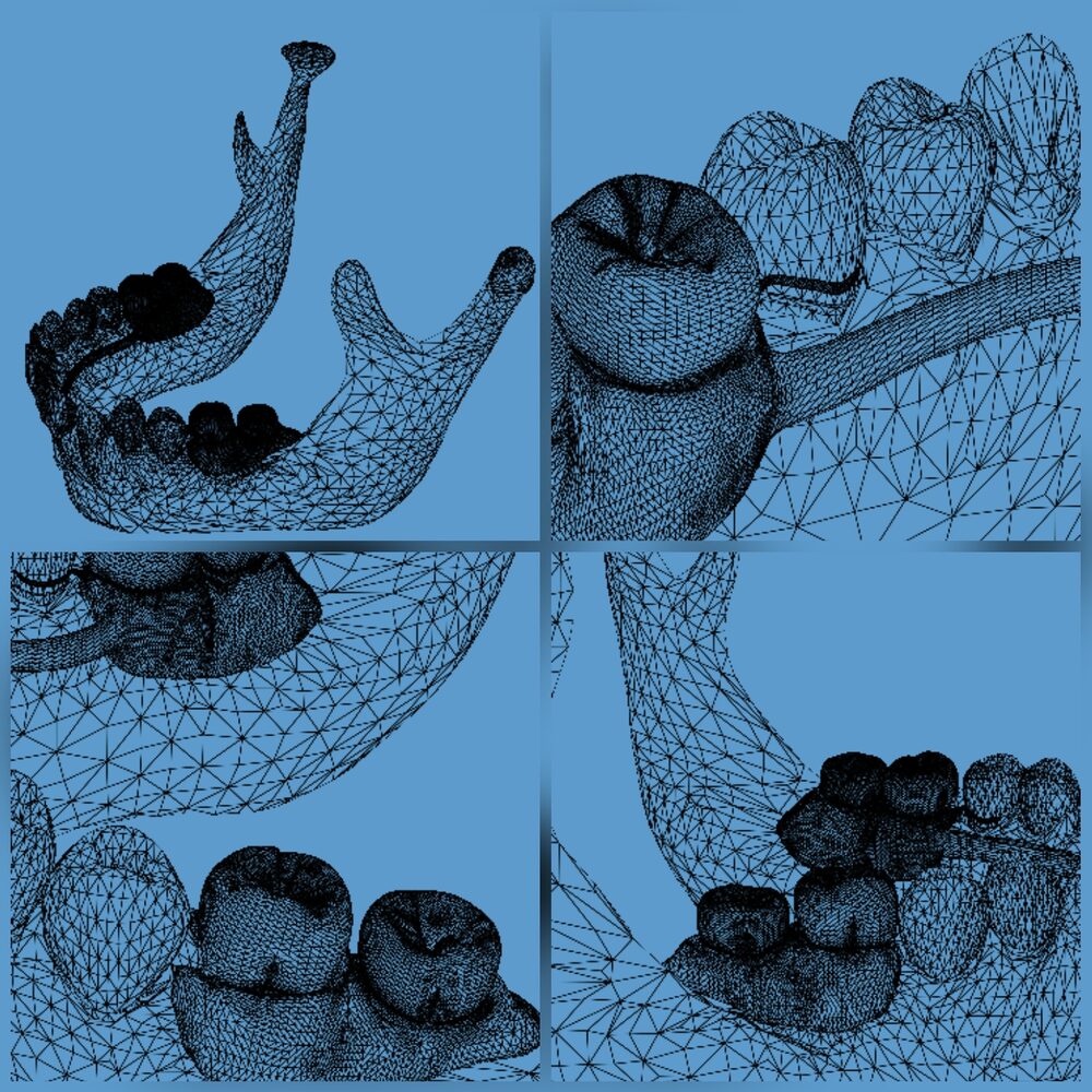 Бредент — wireframe-сетка нижней челюсти, крупные планы зубов